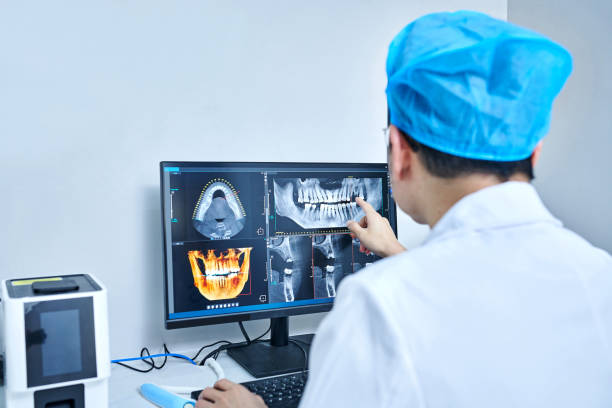 Best Emergency Wisdom Teeth Removal in El Segundo, CA